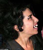 amy-winehouse-teeth.jpg