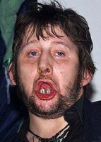 bad-teeth-shane_macgowan.jpg