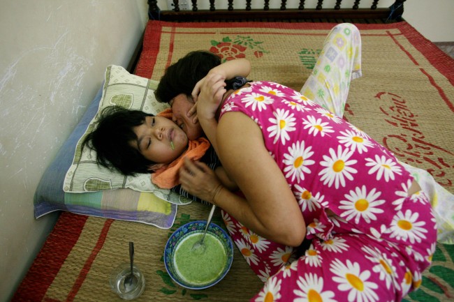 Ngyuyen Thi Thuy Lieu kisses and hugs her daughter Ngyuyen Thi Trang Ngan as she feeds her lunch on their family bed at their home in Danang, Vietnam on Monday, May 21, 2007. Ngyuyen Thi Thuy Lieu, who grew up next to the U.S. military base inside Denang airbase, has given birth to two children with physical and mental disabilities. More than 30 years after the Vietnam War ended, the poisonous legacy of Agent Orange has emerged anew with a scientific study that has found extraordinarily high levels of health-threatening contamination at the former U.S. air base at Danang.