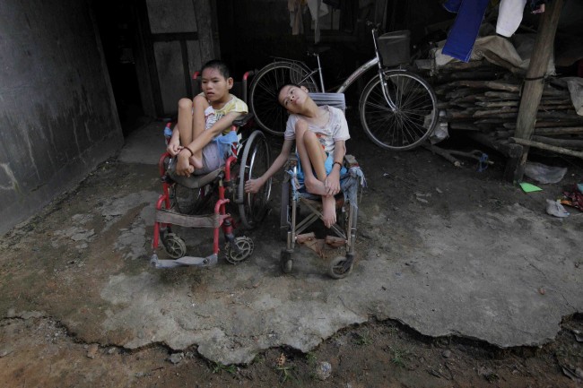 In this photo taken on Oct. 5, 2009, Nguyen Thi Tai, left, and Nguyen Thi Thuyet sit together in their wheelchairs outside their family home in the village of Cam Tuyen, Vietnam. The two young women were born with profound physical and mental disabilities that the family, and local officials say, were caused by their parents' exposure to the chemical dioxin in the defoliant Agent Orange. 