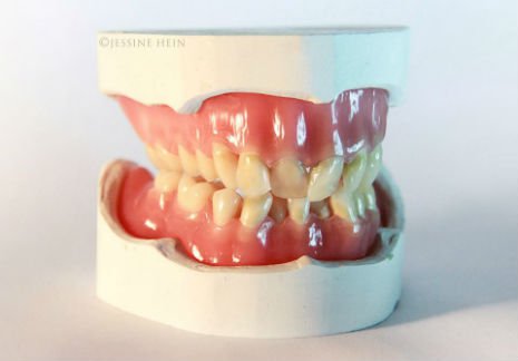 bowie teeth 1