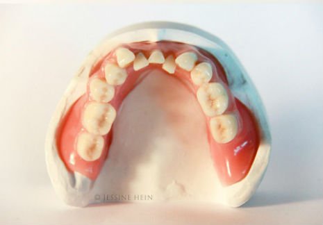 bowie teeth 3