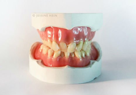 bowie teeth 4